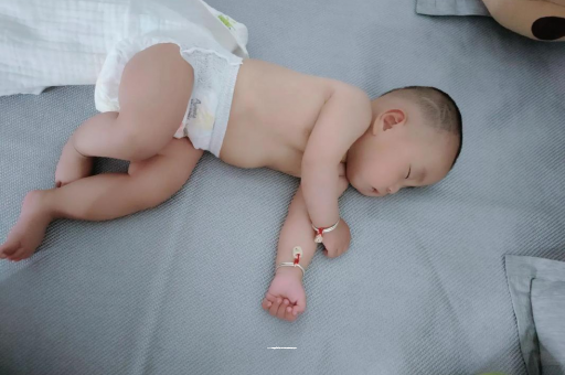 长兴六个月宝宝眼睛散光